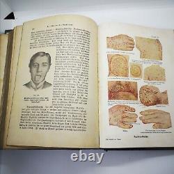 Antique Medical Book Medicine German Rare & Edition S Books Surgery Ed 2 First
