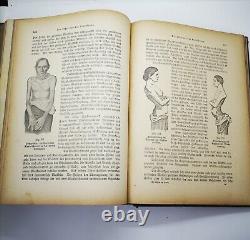Antique Medical Book Medicine German Rare & Edition S Books Surgery Ed 2 First