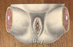 Collection of 10 Antique books on the Women's Anatomy, Gynacological