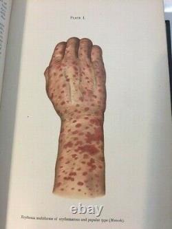 DISEASES OF THE SKIN Rare Antique Medical Book of 1902 Dermatology Stelwagon
