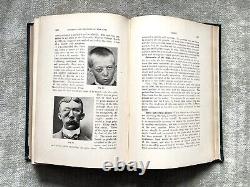 Eye Disease, Anomalies, Rare, Antique Medical Book, 1902, Illustrated, Good Cond