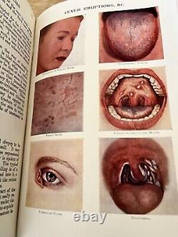 RARE ANTIQUE MEDICAL BOOK OVER 100 YEARS OLD! COLOR PLATES FREAKS SURGERY Odd