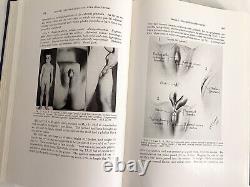 RARE Genital Abnormalities Hermaphroditism Adrenal 1937 Antique Medical Book 1st