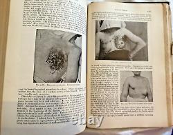 RARE Modern Surgery General Operative DaCosta 1919 Antique Medical Book Illustra