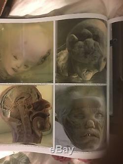 Rare Ernst Hausner Book Anomalies, Medical Oddities, Freaks, Anatomical Curiosities
