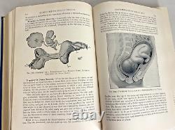 VG+ Williams Obstetrics Henricus Stander 1941 Antique Medical Book OBGYN RARE